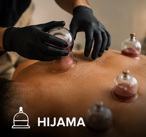hijama